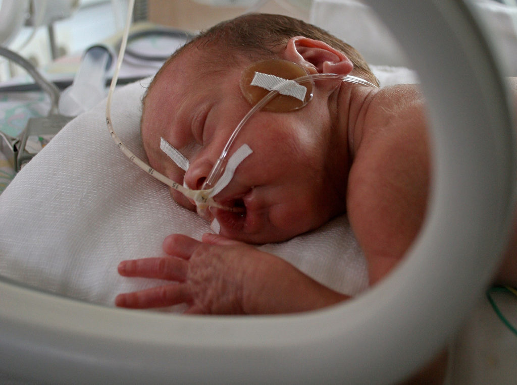 Orwind O4801 NICU Baby Security Camera
