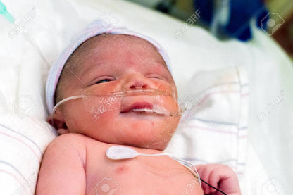Orwind O4801 NICU Baby Security Camera